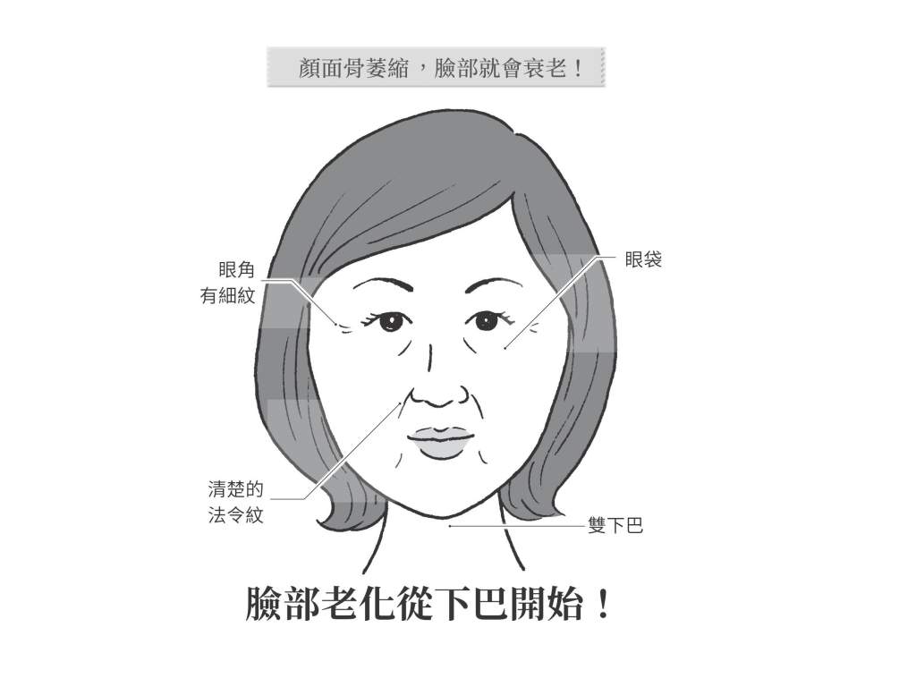  骨質疏鬆 導致臉部老化